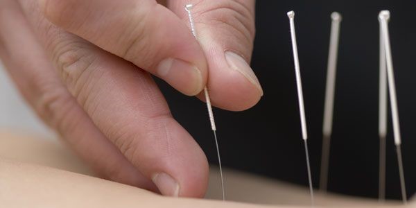 Acupuncture Profile